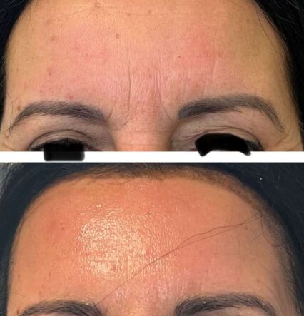 486623150_1068534795292733_1672120365599328968_n www.eiraestetica.fi 486623150 1068534795292733 1672120365599328968 n 486623150 1068534795292733 1672120365599328968 n